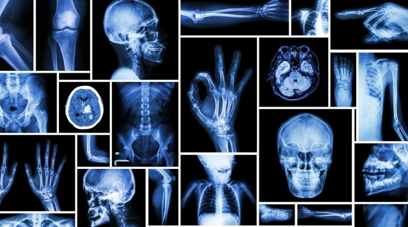 How Radiology Works