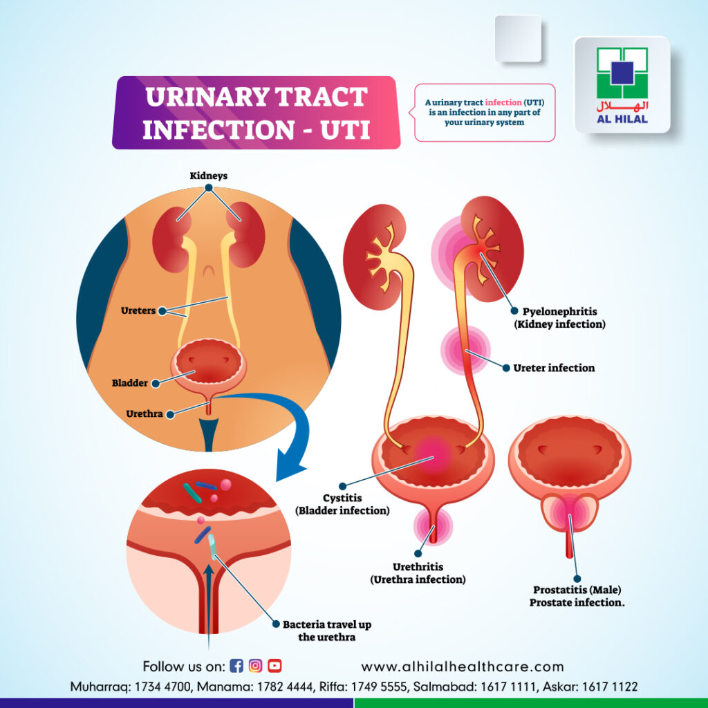 case study 52 urinary tract infection