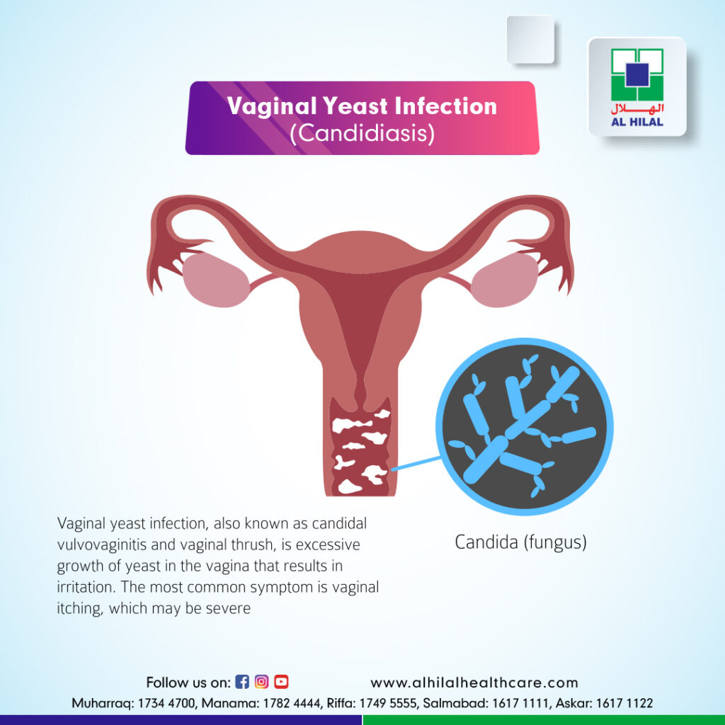 What is the main cause of a yeast deals infection