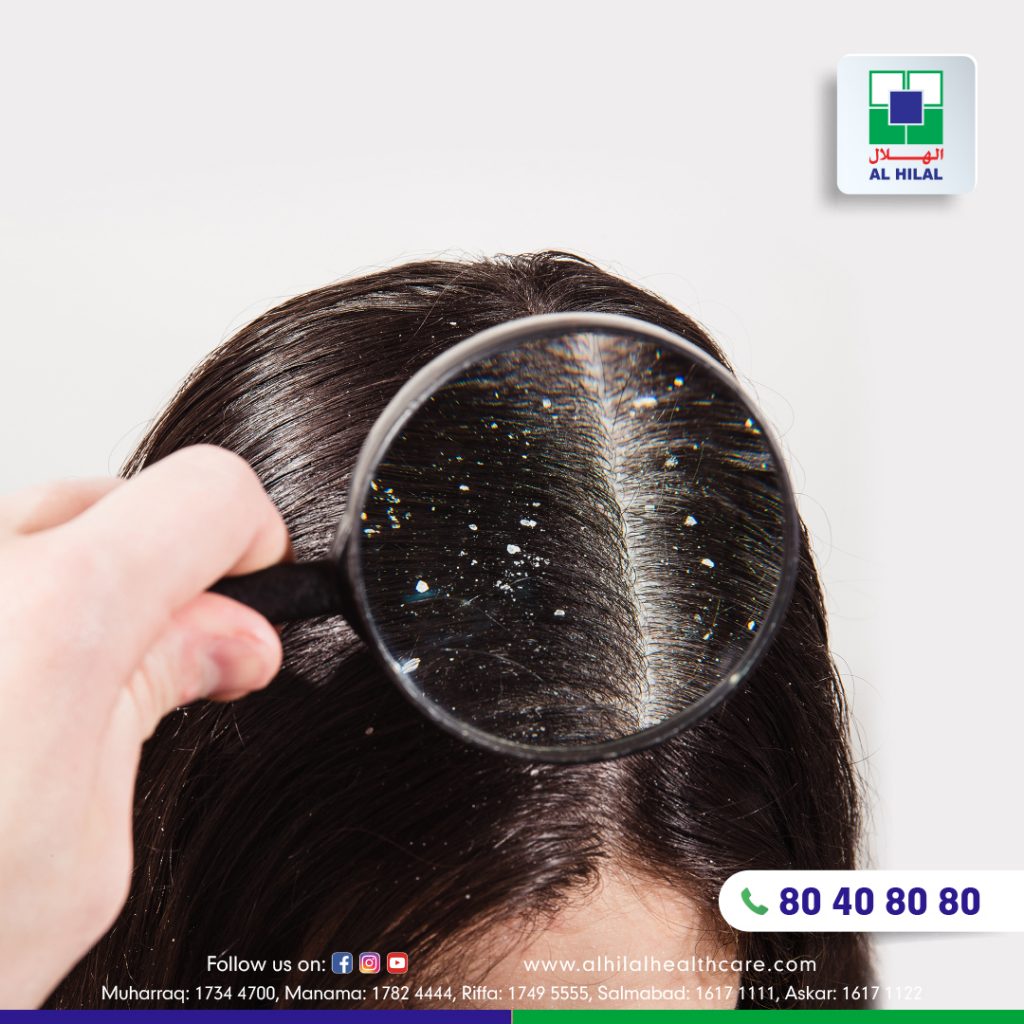 What is Dandruff? Symptoms, Causes, Diagnosis & Treatment